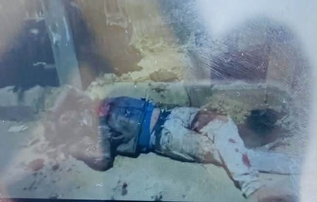 कीर्तिपुरमा सवारी दुर्घटना,  घाईते पारसको ट्रमा सेन्टरमा उपचार हुँदै